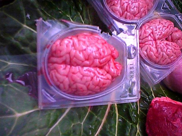 ... el cerebro